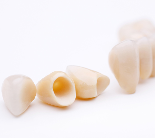 Houston Dental Crowns and Dental Bridges