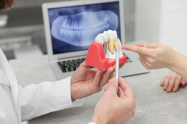 Eating And Speaking With Dental Implants