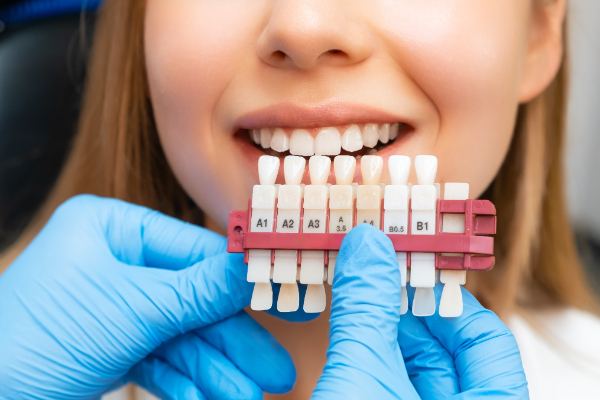 Adjusting To Your New Life With Dental Veneers