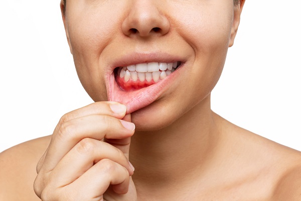 How Treating Gum Disease Can Improve Your Smile