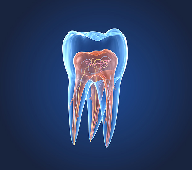Houston What is an Endodontist